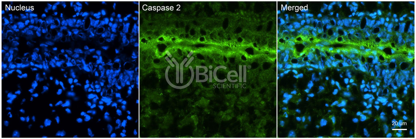 Caspase-2 (CASP2 or NEDD2) Antibody - FFPE Validated