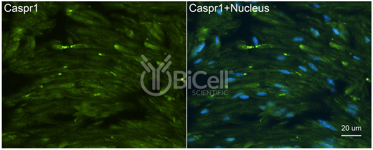 CASPR1 (CNTNAP1 or Paranodin) Antibody - Western Blot Validated