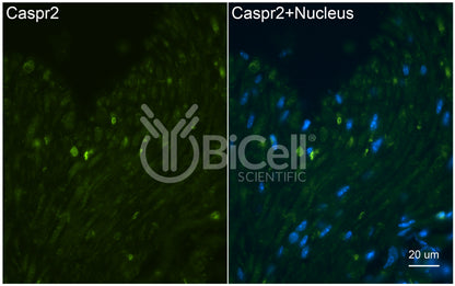 CASPR2 (CNTNAP2) Antibody - Western Blot Validated