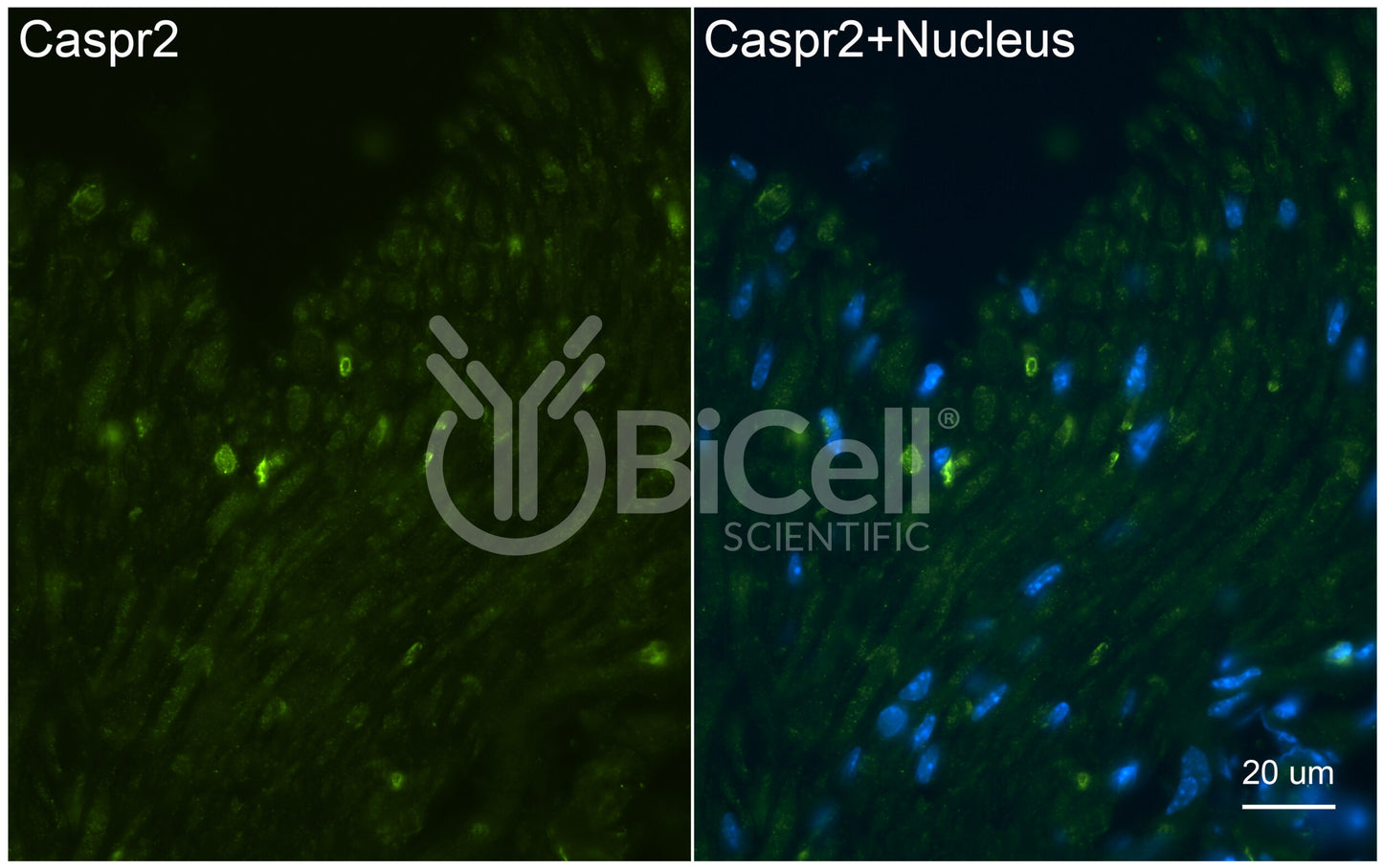 CASPR2 (CNTNAP2) Antibody - FFPE Validated