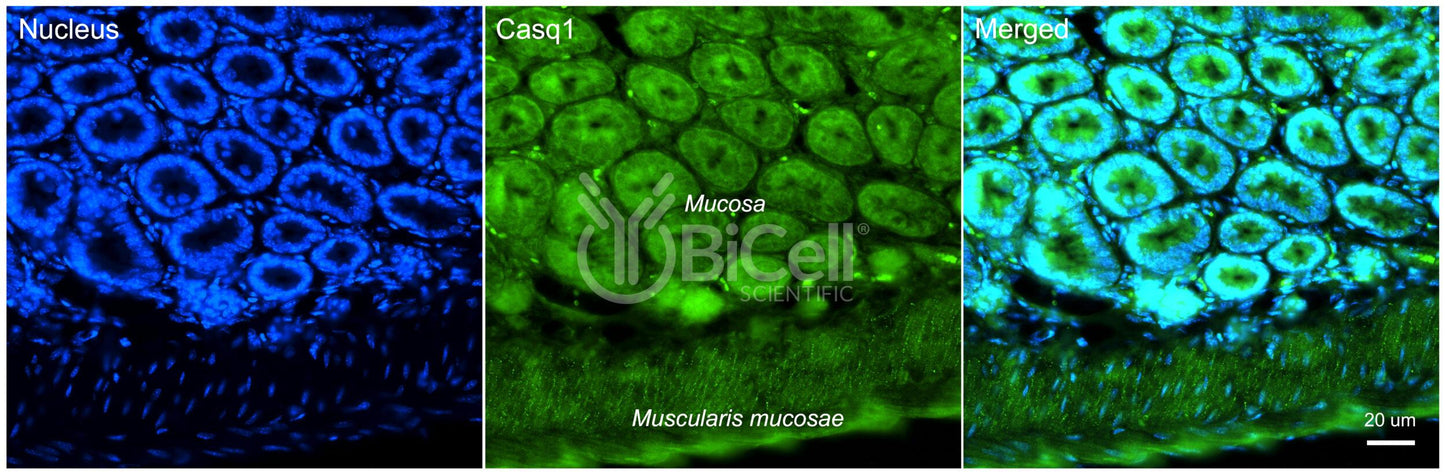 Calsequestrin-1 (CASQ1) Antibody