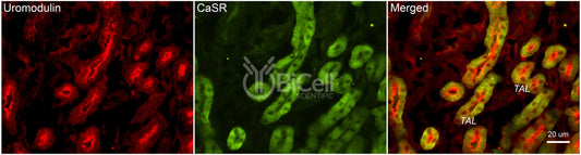CaSR Antibody - Western Blot Validated