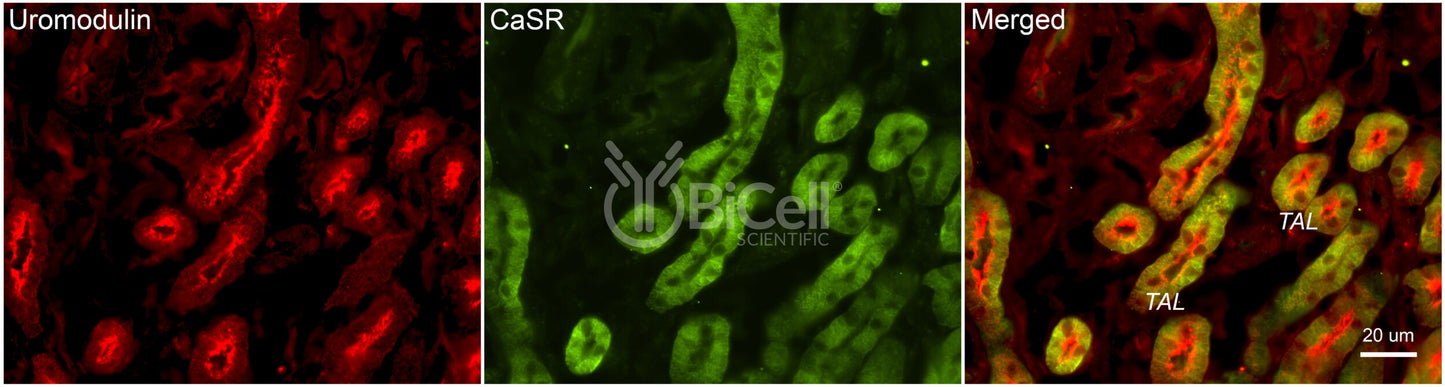CaSR Antibody - FFPE Validated