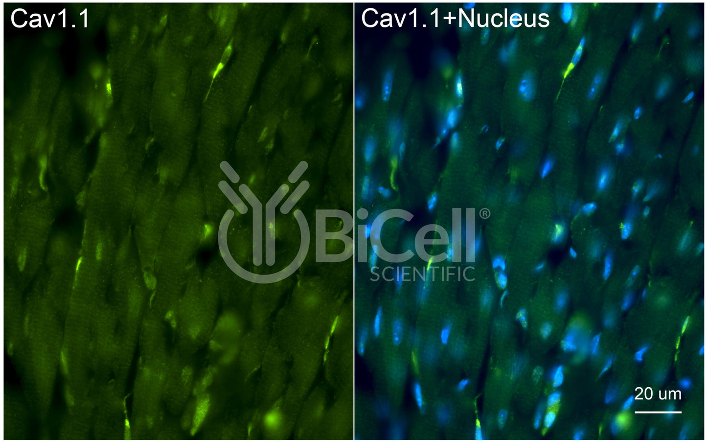 CACNA1S (Cav1.1) Antibody - Western Blot Validated