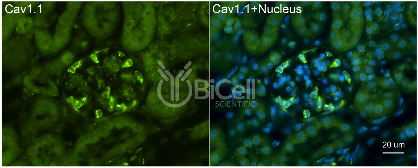 CACNA1S (Cav1.1) Antibody - FFPE Validated