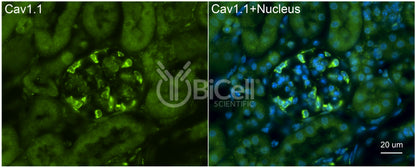 CACNA1S (Cav1.1) Antibody