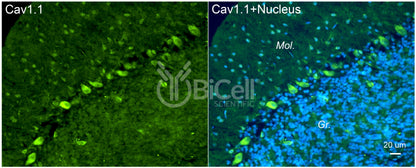 CACNA1S (Cav1.1) Antibody - FFPE Validated