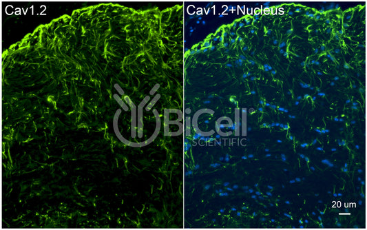 CACNA1C (Cav1.2) Antibody - FFPE Validated