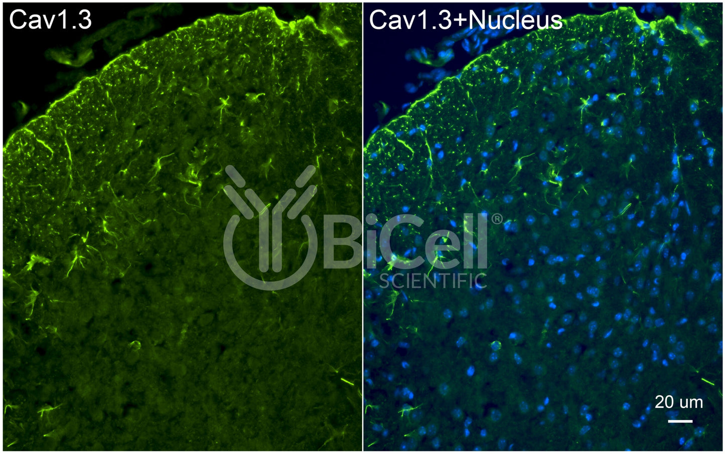 CACNA1D (Cav1.3) Antibody - Western Blot Validated
