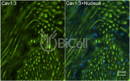 CACNA1D (Cav1.3) Antibody - FFPE Validated