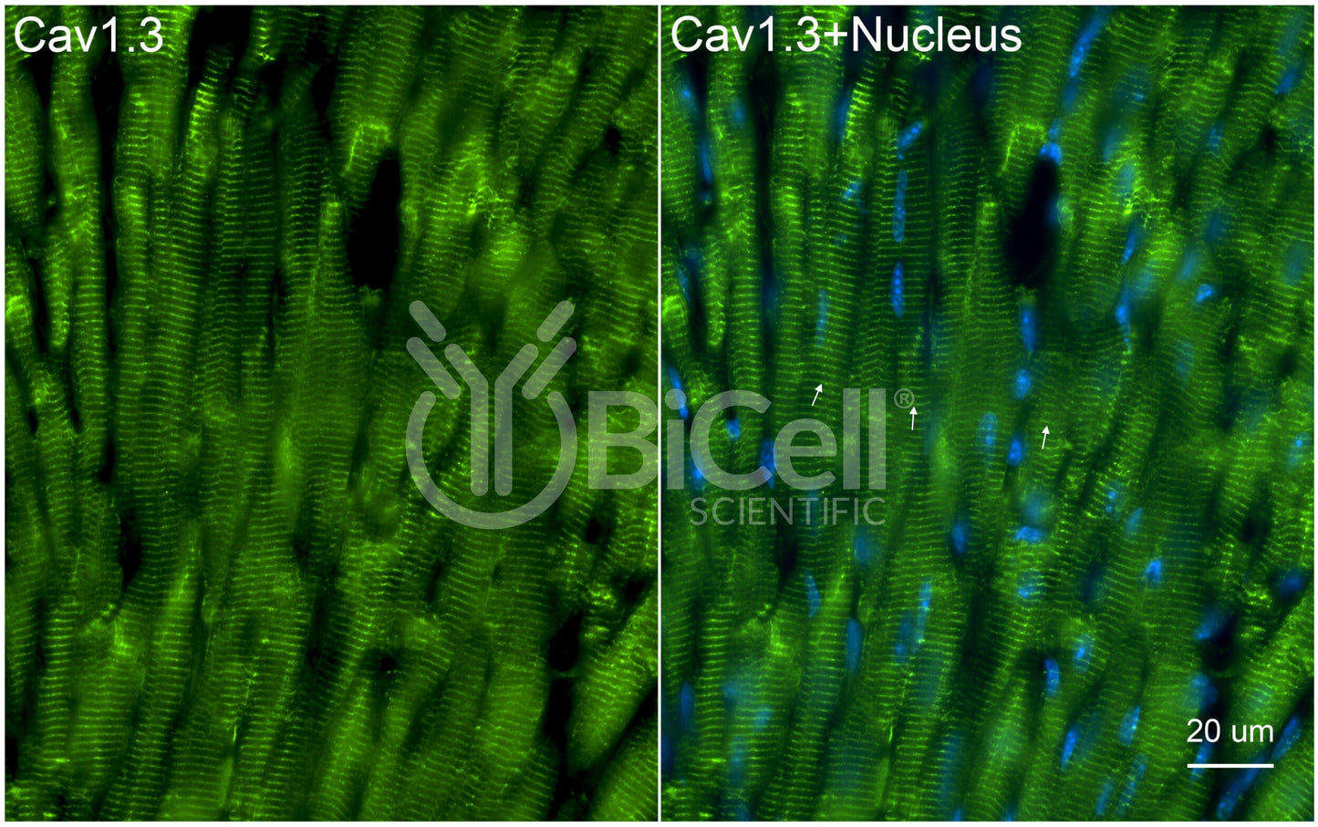 CACNA1D (Cav1.3) Antibody - Western Blot Validated