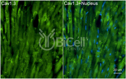 CACNA1D (Cav1.3) Antibody - FFPE Validated
