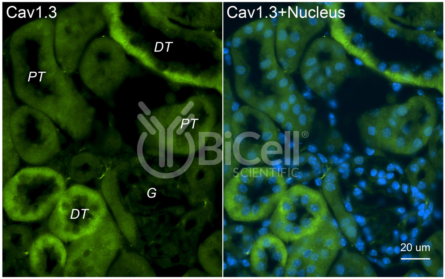 CACNA1D (Cav1.3) Antibody - Western Blot Validated