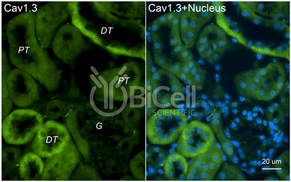 CACNA1D (Cav1.3) Antibody