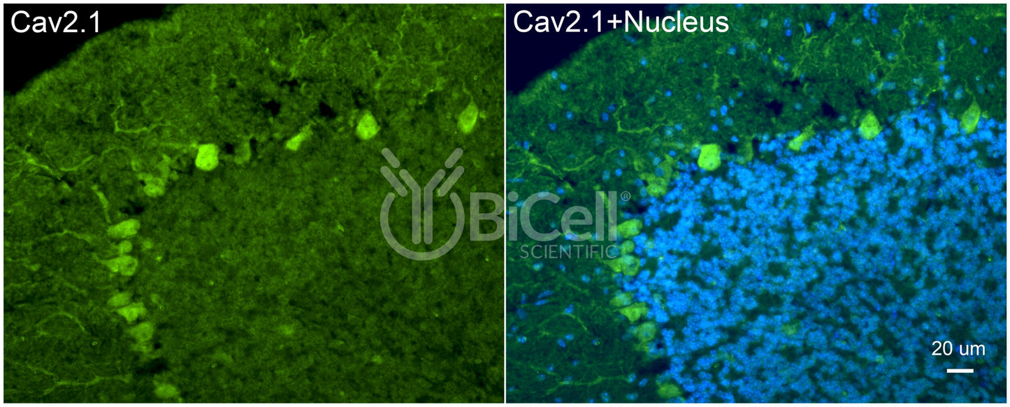 CACNA1A (Cav2.1) Antibody - Western Blot Validated