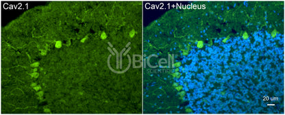 CACNA1A (Cav2.1) Antibody - Western Blot Validated