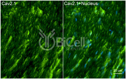 CACNA1A (Cav2.1) Antibody - Western Blot Validated