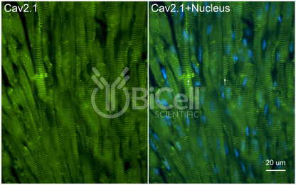 CACNA1A (Cav2.1) Antibody