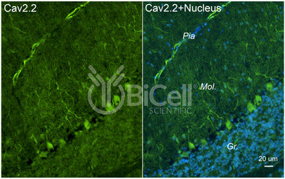 CACNA1B (Cav2.2) Antibody