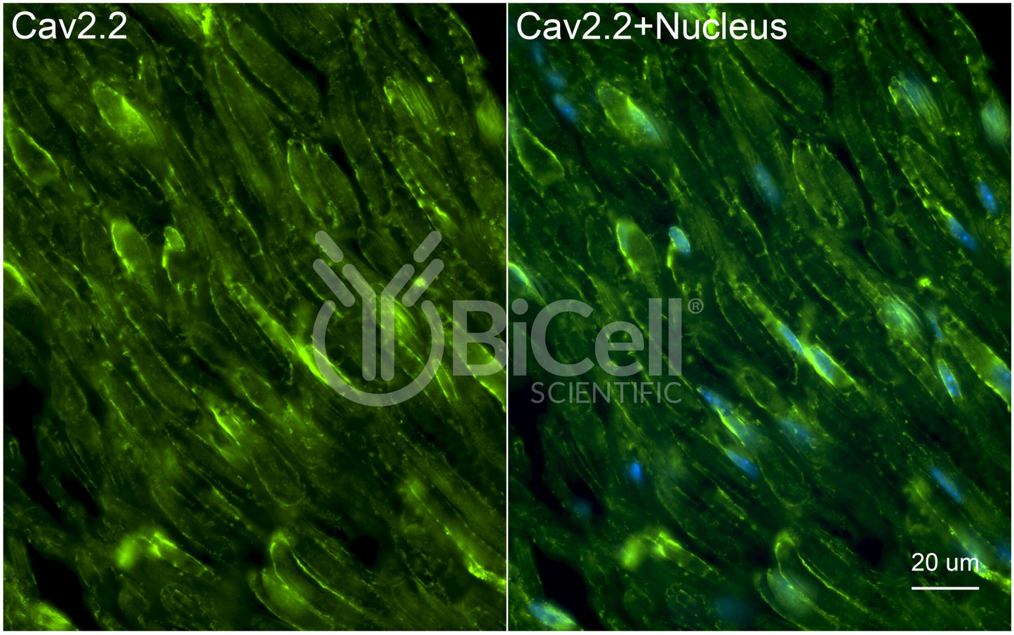 CACNA1B (Cav2.2) Antibody - Western Blot Validated