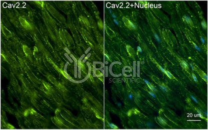 CACNA1B (Cav2.2) Antibody