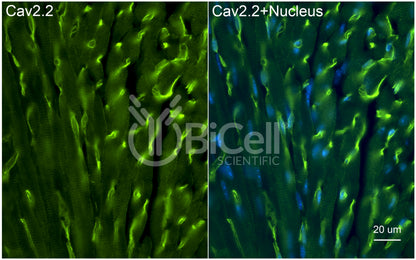 CACNA1B (Cav2.2) Antibody - FFPE Validated