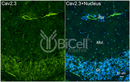CACNA1E (Cav2.3) Antibody - Western Blot Validated