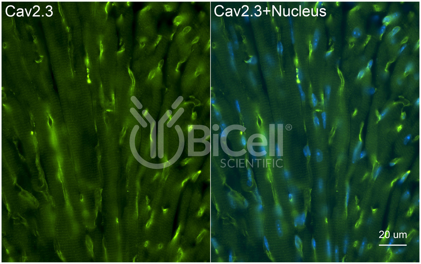 CACNA1E (Cav2.3) Antibody - Western Blot Validated