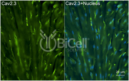 CACNA1E (Cav2.3) Antibody - Western Blot Validated