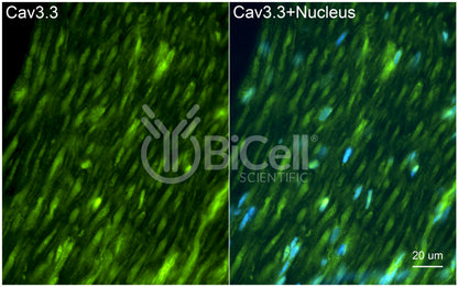 CACNA1I (Cav3.3) Antibody