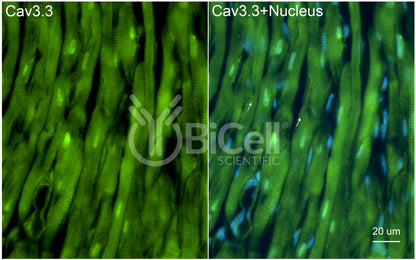 CACNA1I (Cav3.3) Antibody - FFPE Validated