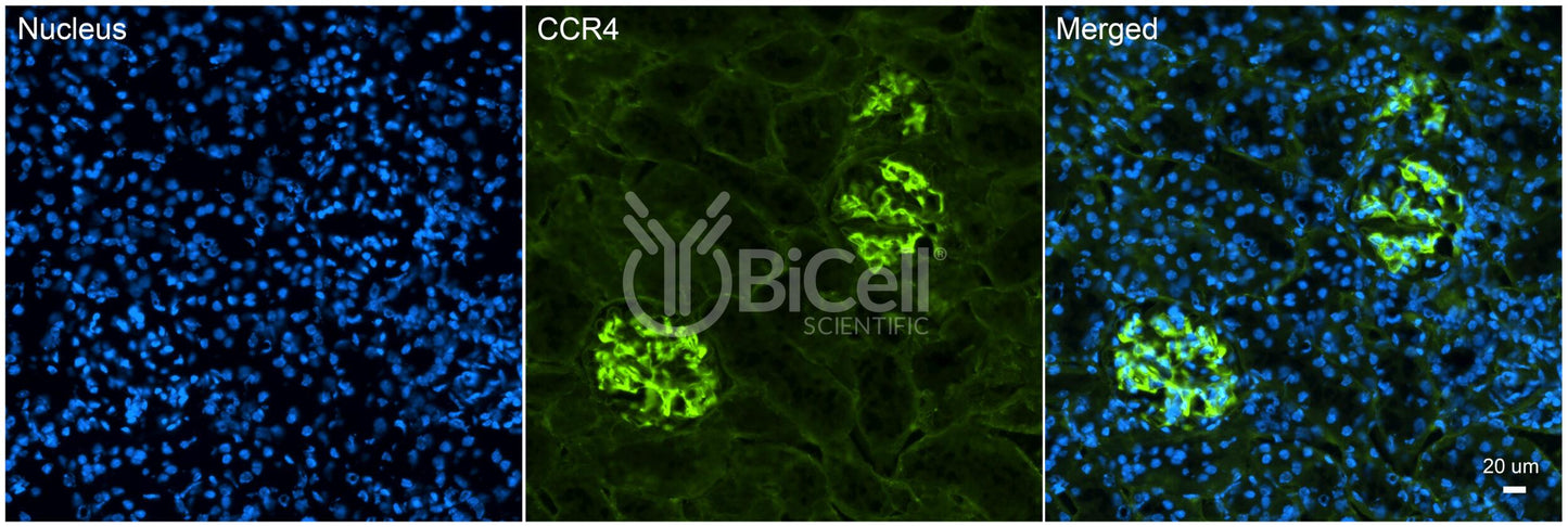 CCR4 (CD194) Antibody