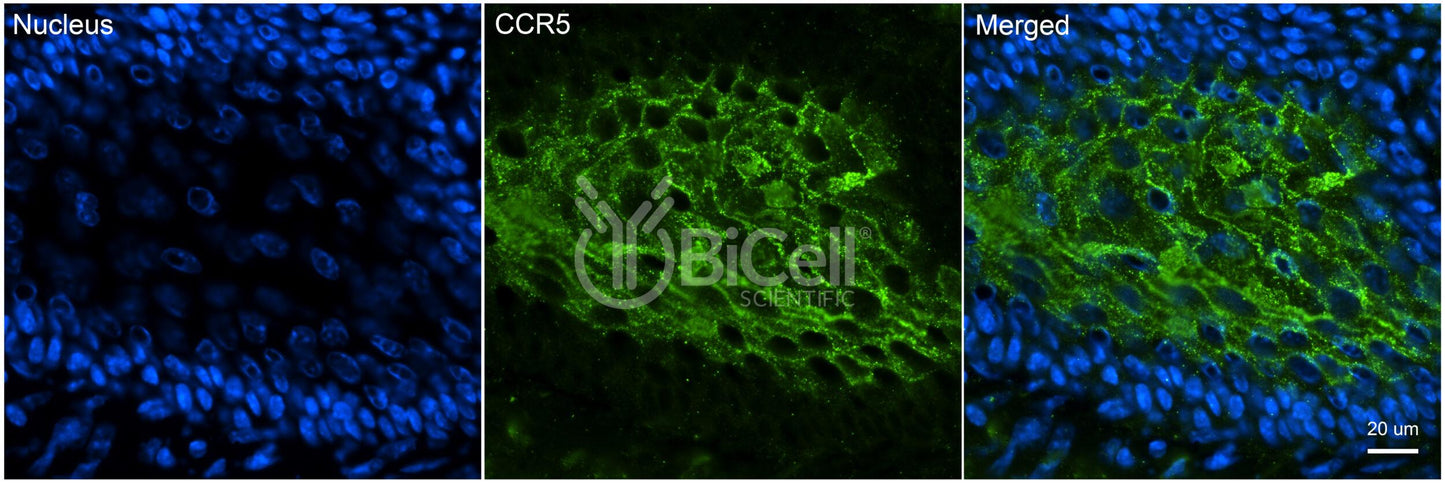 CCR5 (CD195) Antibody - Western Blot Validated
