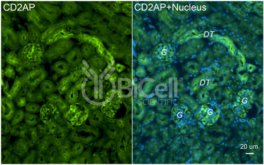 CD2AP Antibody - Western Blot Validated
