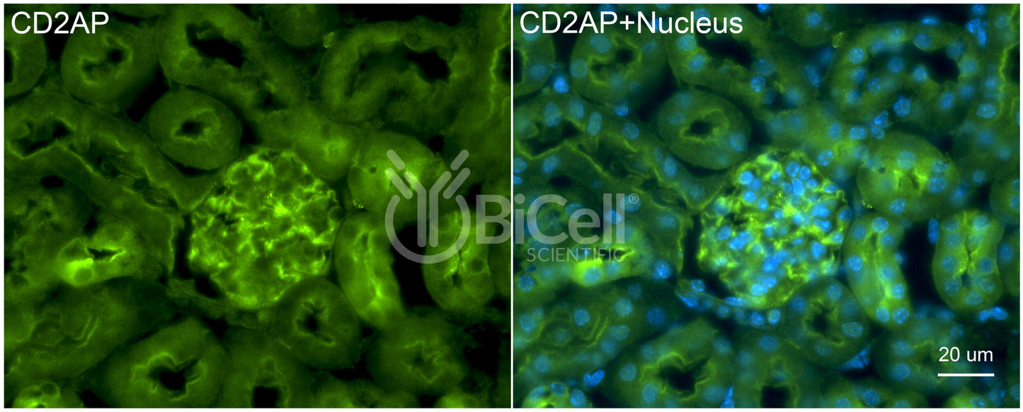 CD2AP Antibody - FFPE Validated
