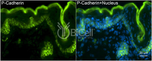 P-Cadherin (Cadherin-3 or CDH3) Antibody - Western Blot Validated