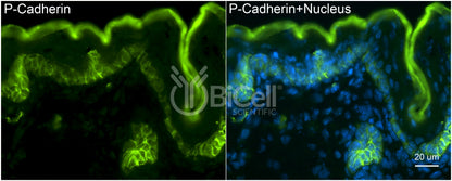 P-Cadherin (Cadherin-3 or CDH3) Antibody - FFPE Validated