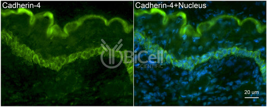 R-Cadherin (Cadherin-4 or CDH4) Antibody - Western Blot Validated