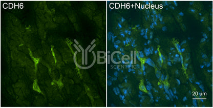 Cadherin-6 (CDH6) Antibody - FFPE Validated