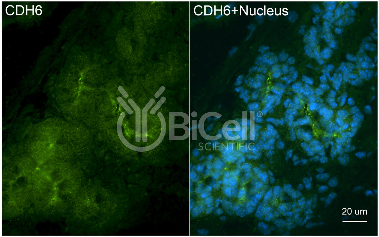 Cadherin-6 (CDH6) Antibody - FFPE Validated