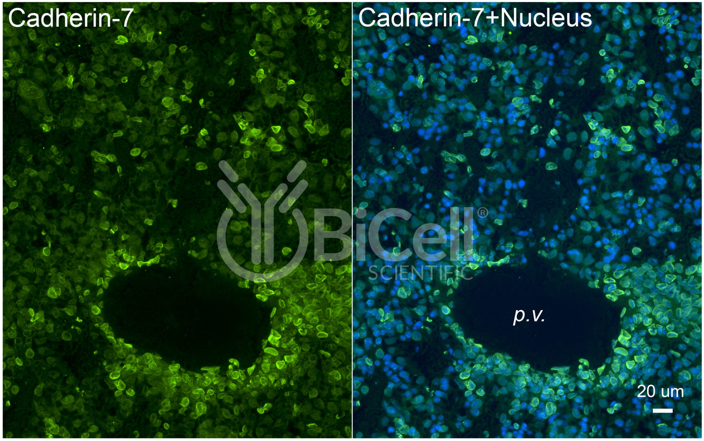 Cadherin-7 (CDH7) Antibody - FFPE Validated