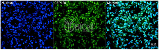CEP120 (CCDC100) Antibody