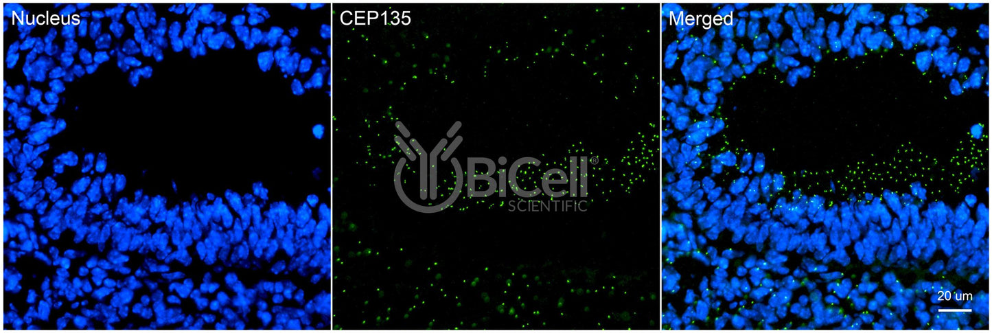 CEP135 (KIAA0635) Antibody - Western Blot Validated