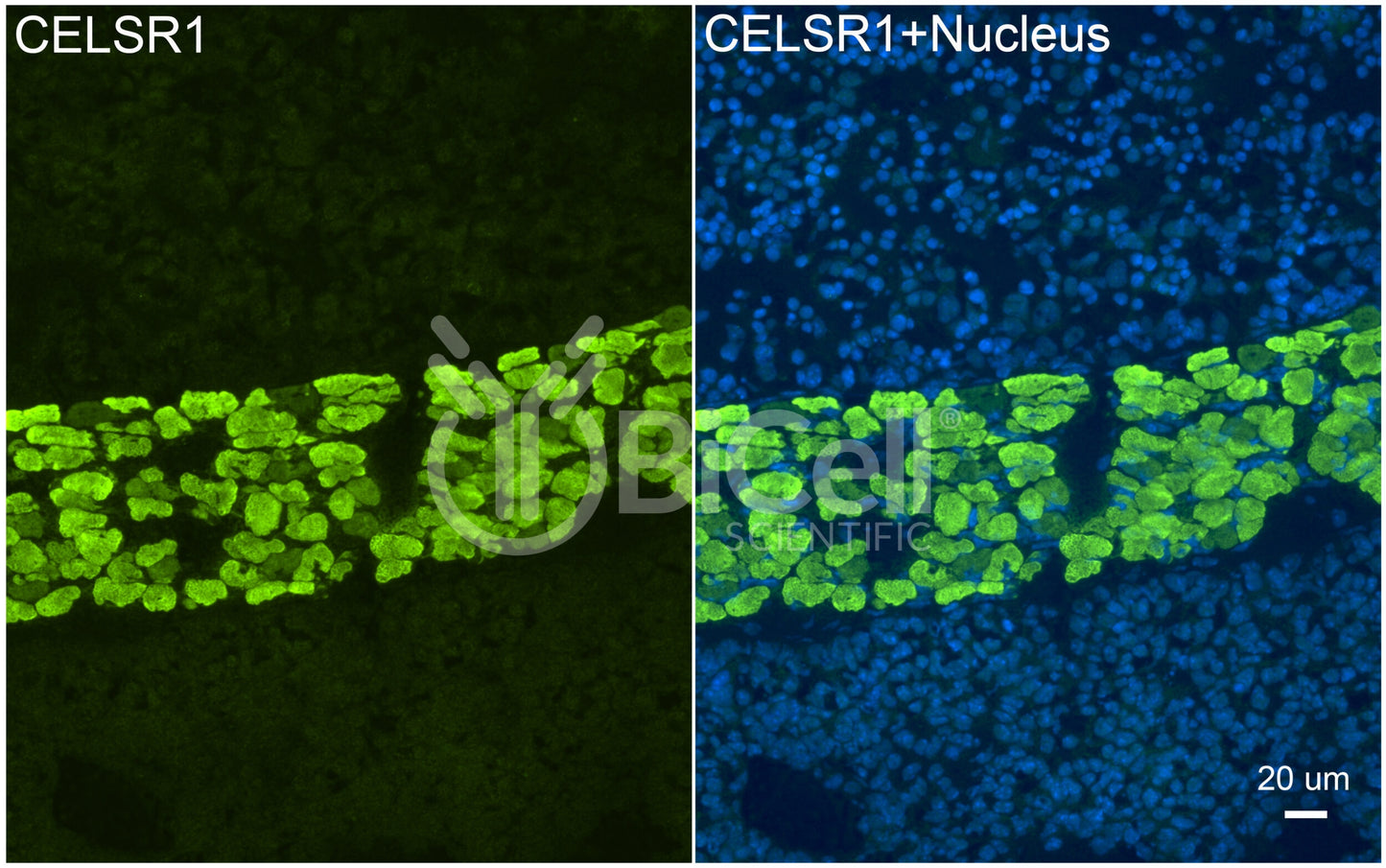 CELSR1 (CDHF9 or FMI2) Antibody - FFPE Validated