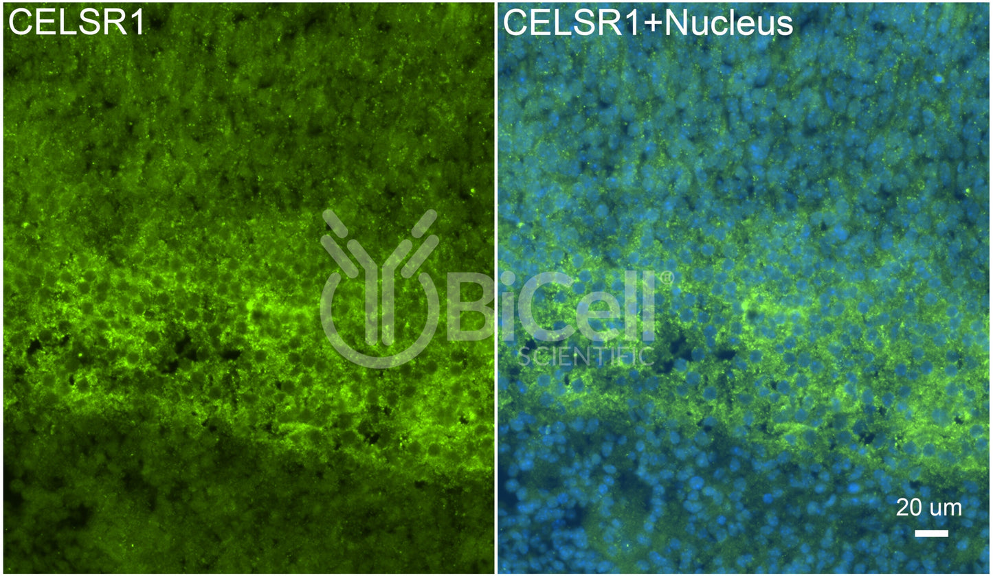 CELSR1 (CDHF9 or FMI2) Antibody - FFPE Validated