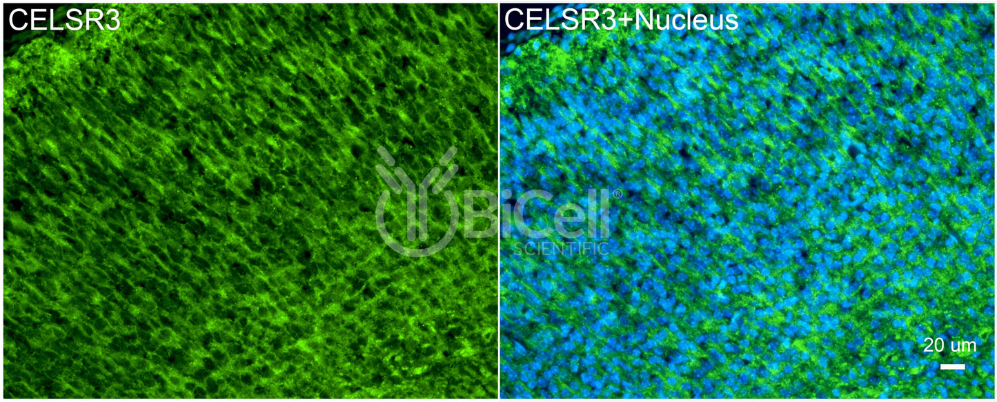 CELSR3 (CDHF11 or FMI1) Antibody - FFPE Validated