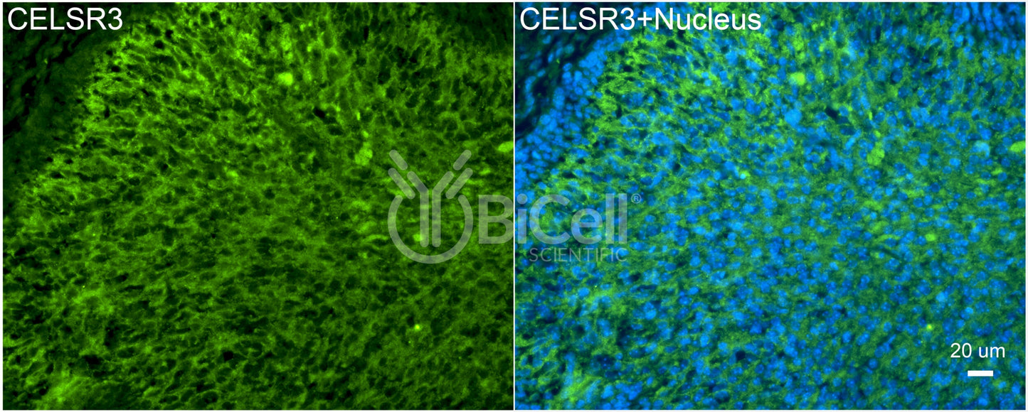 CELSR3 (CDHF11 or FMI1) Antibody - FFPE Validated