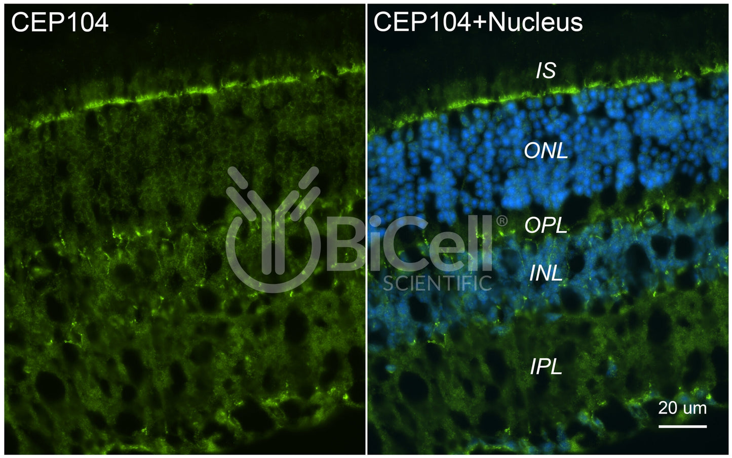 CEP104 Antibody