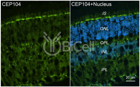 CEP104 Antibody