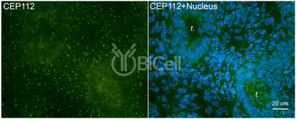 CEP112 (CCDC46) Antibody